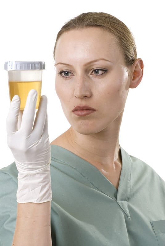 female lab technician holding urine specimen
